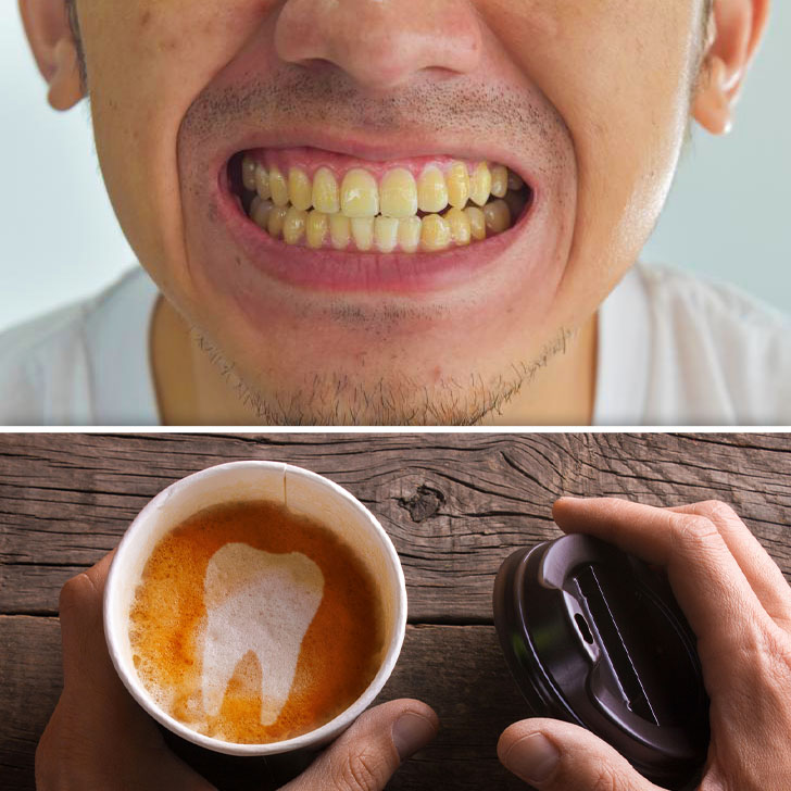 Caffé che macchia i denti